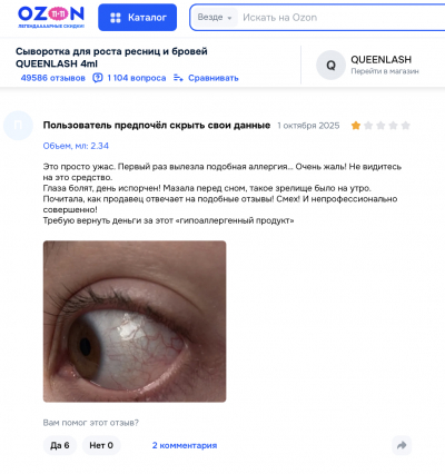 Queenlash отзывы: Разоблачение мифа о сыворотке для роста ресниц